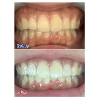 MBEAUTYSALON 千葉店・京成大久保所属・Melty 輝のその他イメージ