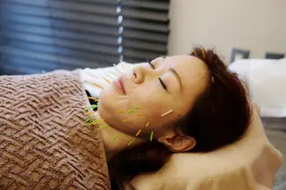 Acupuncture  salon LINOA リノア鍼灸院所属・ヘッドスパ鍼/小顔鍼 耳ツボ 　LINOAのエステ・リラクイメージ