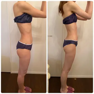 FLEUR大阪・整体 ・ハイフ・痩身・小顔のエステ・リラクイメージ