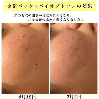 Bellesthe (ベルエステ)のエステ・リラクイメージ