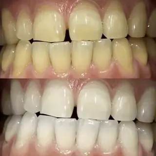 歯科提携セルフダック 宇都宮駒生店のエステ・リラクイメージ