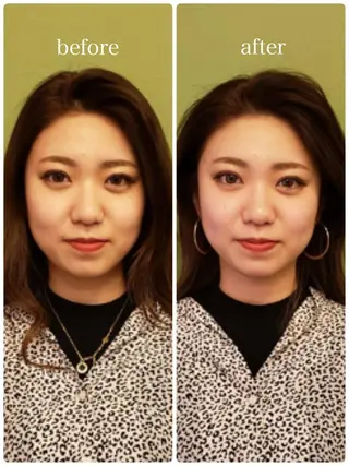 美容鍼 IKEZAKIのエステ・リラクイメージ