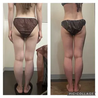 ハイパーナイフ専門店 Salon de COCO所属・Salon de COCOのエステ・リラクイメージ