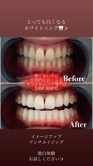 ライトビューティー 恵比寿店のその他イメージ