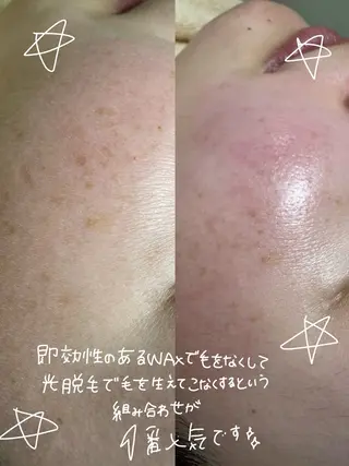 UNI ~mizuki~のエステ・リラクイメージ