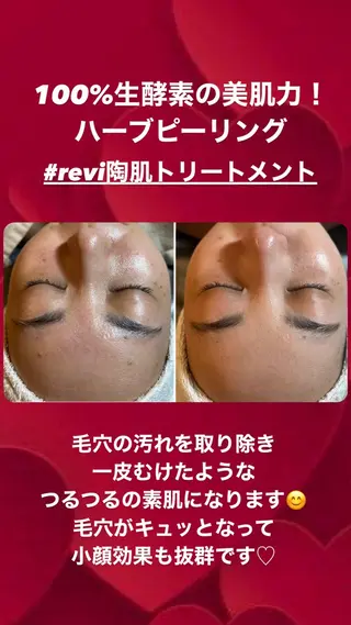 esty hitomiのエステ・リラクイメージ