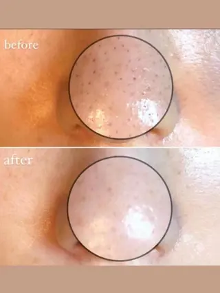 🎀美テラス 🎀のエステ・リラクイメージ