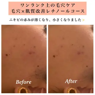 Bellesthe (ベルエステ)のエステ・リラクイメージ