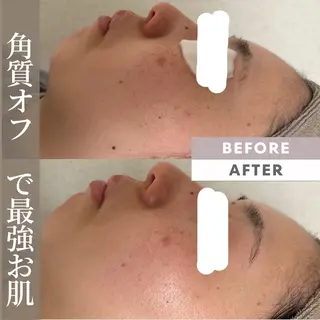 山武•八街　角質オフ フェイシャル🌷ゆかのエステ・リラクイメージ