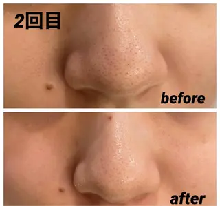 DeI'm   名古屋栄所属・小林 玲菜のエステ・リラクイメージ