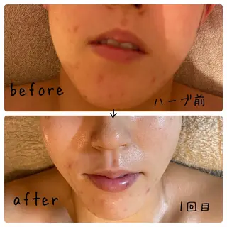 フェアリーローズ所属・fairyrose organicエステのエステ・リラクイメージ