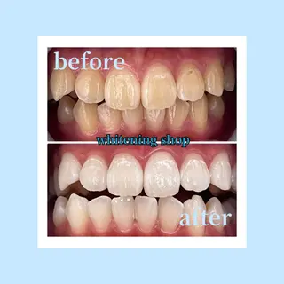 ホワイトニングショップ光明池店所属・ホワイトニング ショップ光明池店のエステ・リラクイメージ