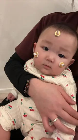 美容鍼灸Solana所属・肌質改善×美容鍼 ゆいのエステ・リラクイメージ