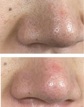 RE:moom リムーム/脱毛エステのエステ・リラクイメージ