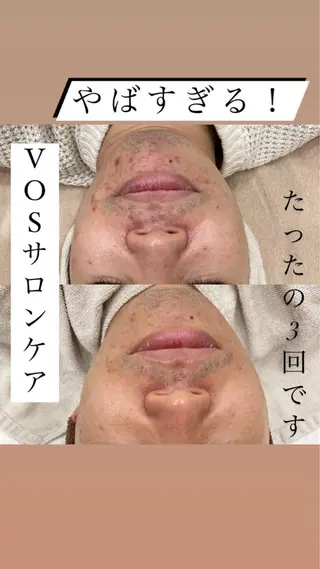 laluna saki...のその他イメージ