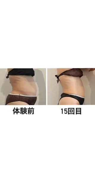 美one所属・美one 山内のエステ・リラクイメージ