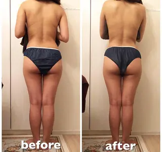 食べながら魅せボディ éclatJua川越のエステ・リラクイメージ