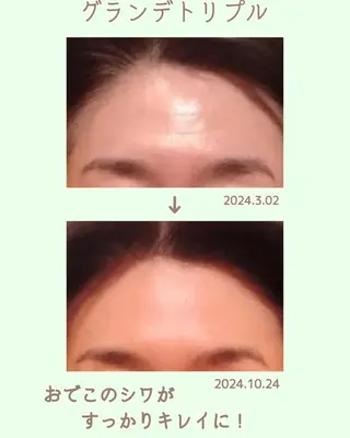 ラブニール 恵比寿店のエステ・リラクイメージ