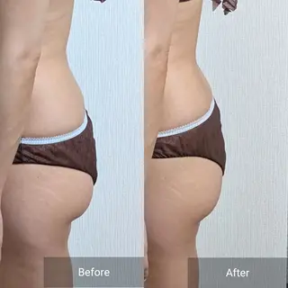 nail RiRi アトレナチュラのエステ・リラクイメージ