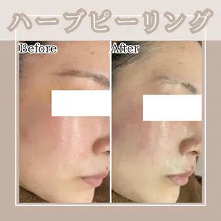 メンズ キッズ Amaryllis 🌹松本のエステ・リラクイメージ