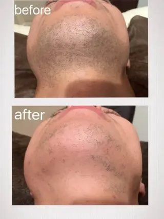 Feather TOMのエステ・リラクイメージ