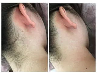 Prima〜プリマ〜 名古屋駅店所属・Prima 痩身脱毛 にごうかおりのエステ・リラクイメージ