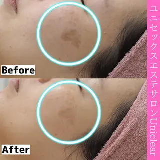 ユニセックスエステサロンUniclear所属・男女エステ ユニクリアのエステ・リラクイメージ