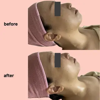 gleam ü 枚方公園のエステ・リラクイメージ