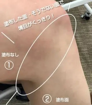 ニキビ、痩身、脱毛、 サクラチャンスパのエステ・リラクイメージ