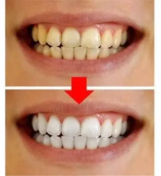 KalanDiva〜 ｶﾗﾝﾃﾞｨｰﾊﾞ〜のエステ・リラクイメージ