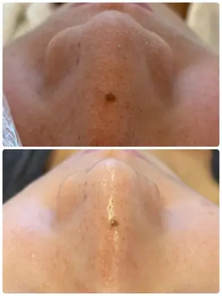 フェイシャル専門 肌質改善/プランスのエステ・リラクイメージ