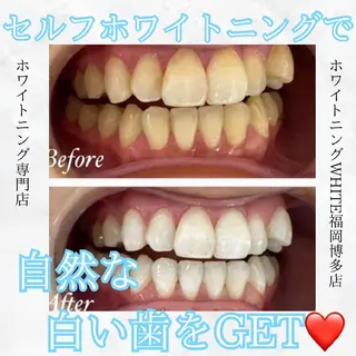 メンズ ホワイトニングサロン WHITE福岡博多店のエステ・リラクイメージ