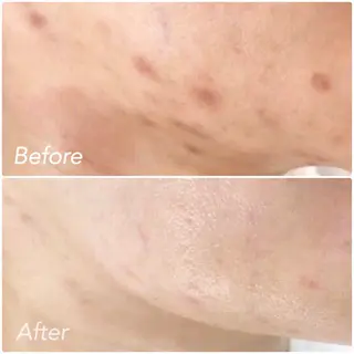 L’Beige レベージュのエステ・リラクイメージ