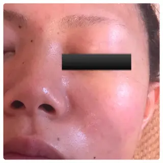 フェアリーローズ所属・fairyrose organicエステのエステ・リラクイメージ