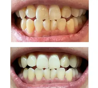 マツエク/まつ毛パーマ/眉毛/ホワイトニング『Élan(エラン)』所属・Élan(エラン) 堺市駅店のマツエク・マツパデザイン