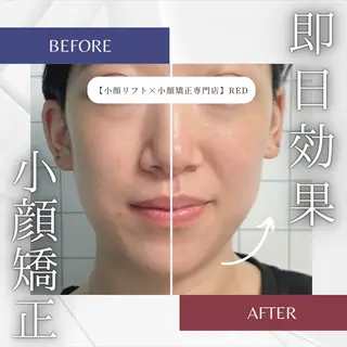 小顔矯正専門店 【RED】池田のエステ・リラクイメージ
