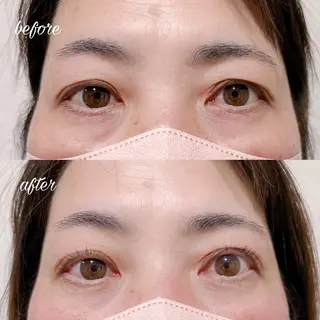 マツエク・マツパ merveilles所属・まつげ/整体/にきび ・アトピー専門サロンのマツエク・マツパデザイン