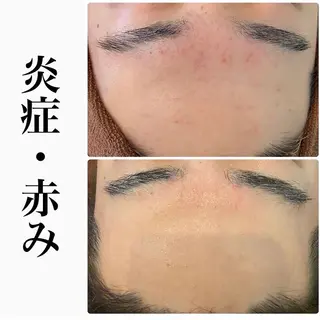 ハーブピーリング専門 BIOEL横浜のエステ・リラクイメージ