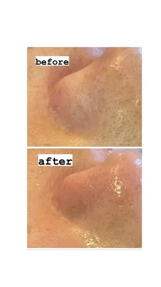 脱毛・エステサロン LuLuNのエステ・リラクイメージ