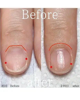 ネイル 木村 千晴のネイルデザイン