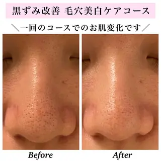 Bellesthe (ベルエステ)のエステ・リラクイメージ