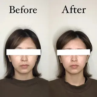 Hari Lounge恵比寿所属・chika🦋 ハリラウンジ恵比寿のエステ・リラクイメージ