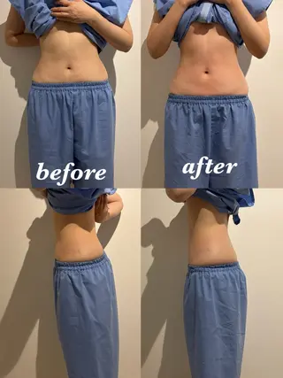 メンズ 腸活サポート みなみののエステ・リラクイメージ