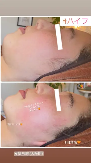 FLEUR大阪・整体 ・ハイフ・痩身・小顔のエステ・リラクイメージ