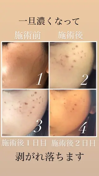 女性のお悩み美容 サロン　ヴィーナスのエステ・リラクイメージ