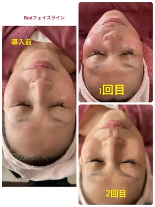 Lien オーナー 山口智嘉のエステ・リラクイメージ