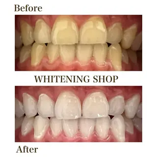 ホワイトニングショップ静岡葵区店所属・ホワイトニング ショップ静岡葵区店のその他イメージ