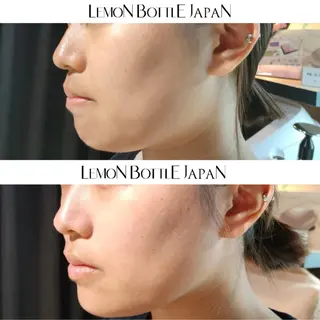 看護師が施術する ナスサロ/Emi🪽のエステ・リラクイメージ