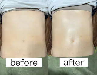 Beauty   Salon  Adiy所属・Adiy ikumiのエステ・リラクイメージ