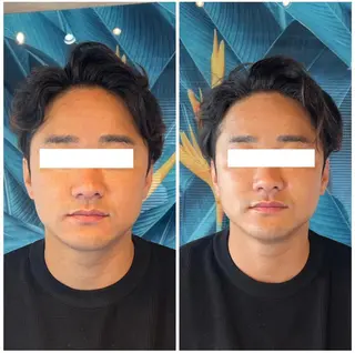 部分痩せ♥️小顔専門 MIKUのエステ・リラクイメージ